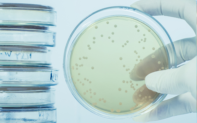Laboratory mold culture (2) Laboratory mold culture (2)