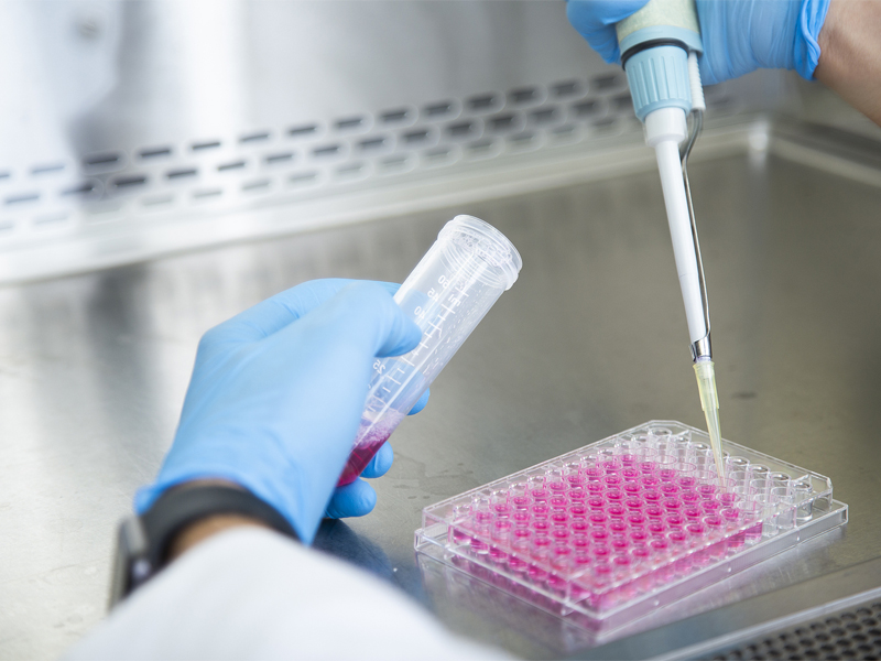 Cell culture Cell culture