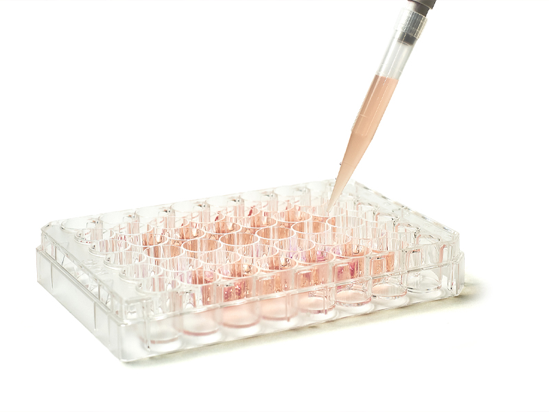 Cell culture Cell culture